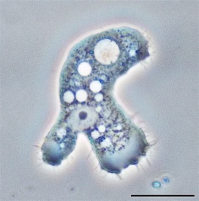  Acanthamoeba: ¿Un depredador microscópico que habita en aguas estancadas?